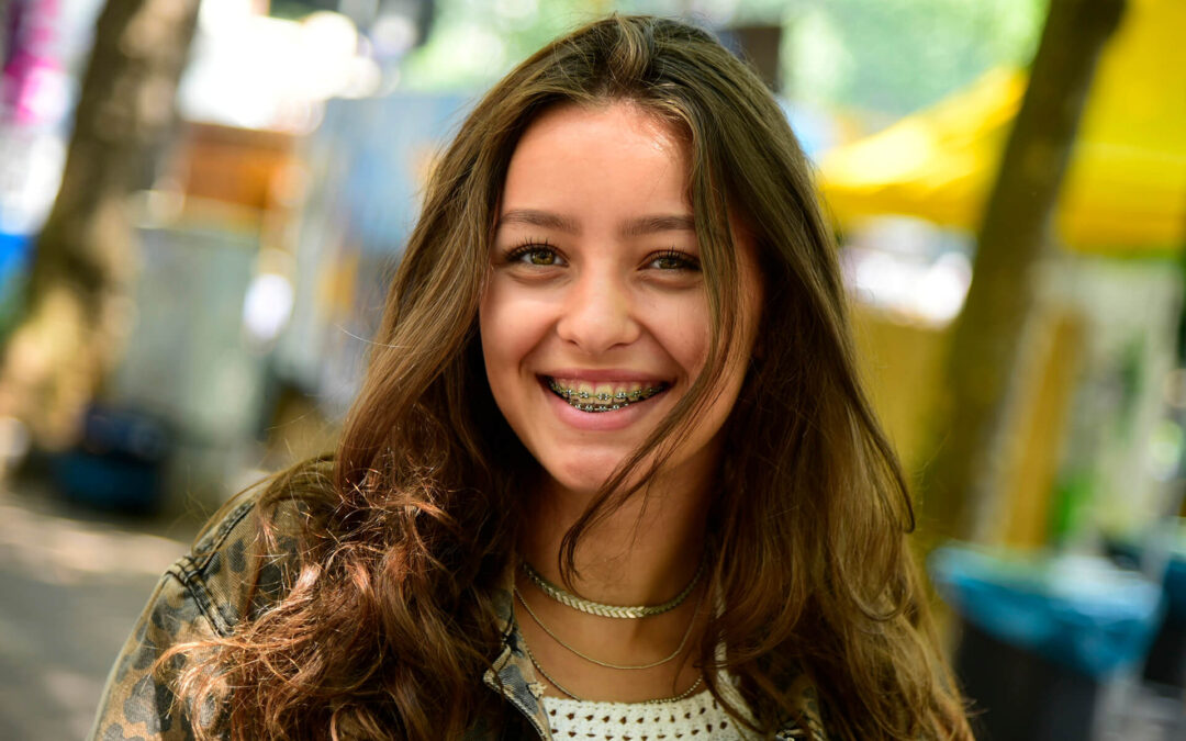 Ortodontistler dudak simetrisini iyileştirebilir.